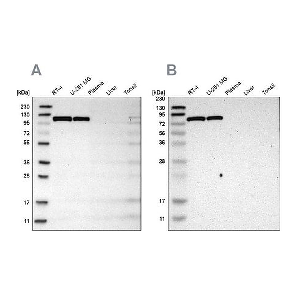 Merck Anti-HK1 antibody produced in rabbit