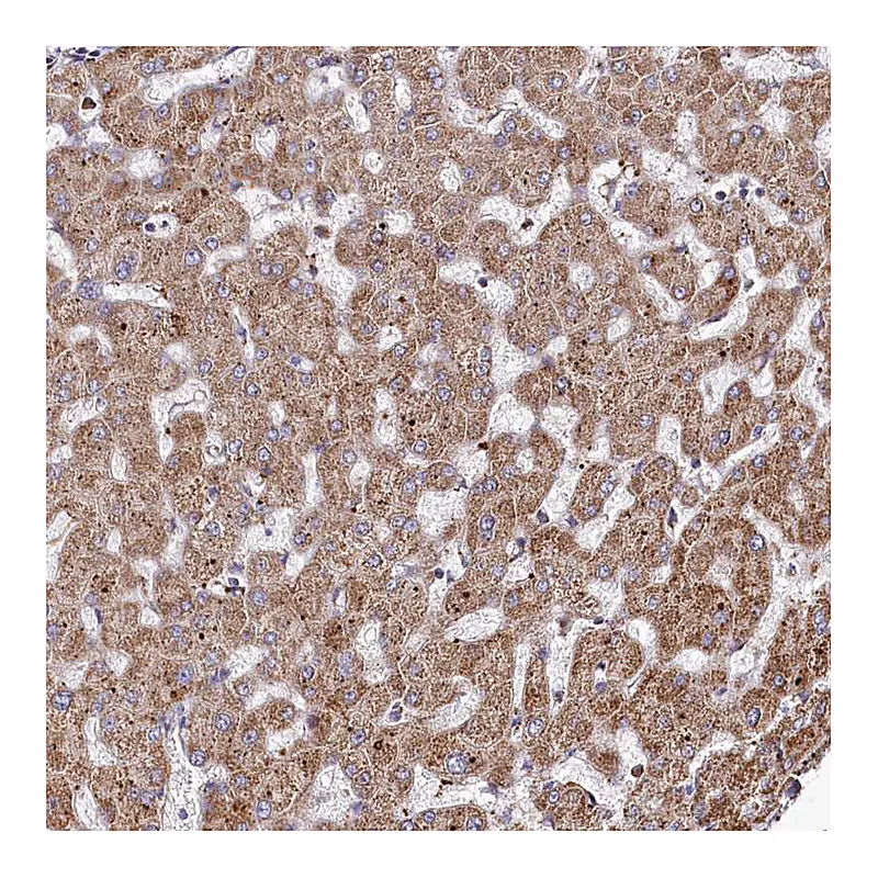 Atlas Antibodies Anti-PSTK Antibody