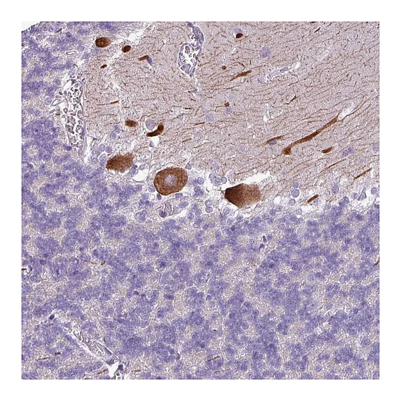 Atlas Antibodies Anti-PSRC1 Antibody