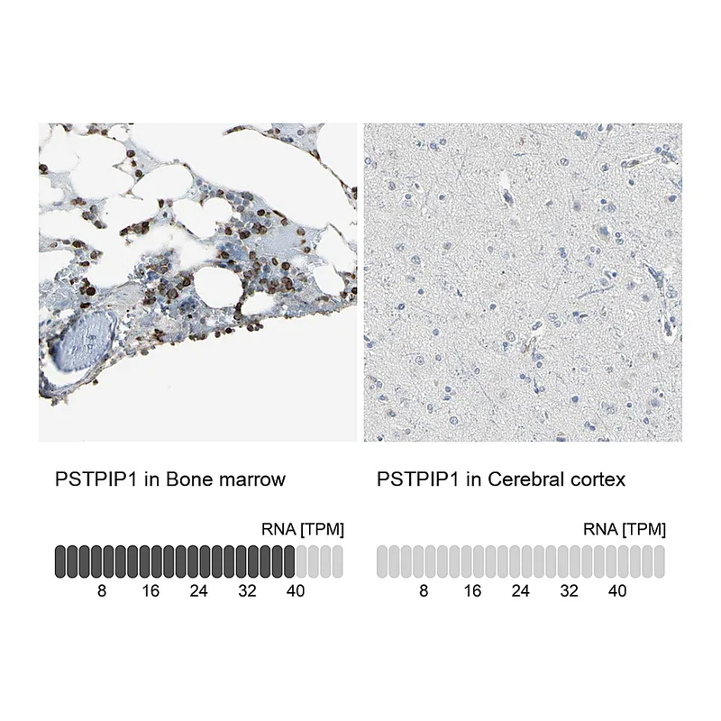 Atlas Antibodies Anti-PSTPIP1 Antibody