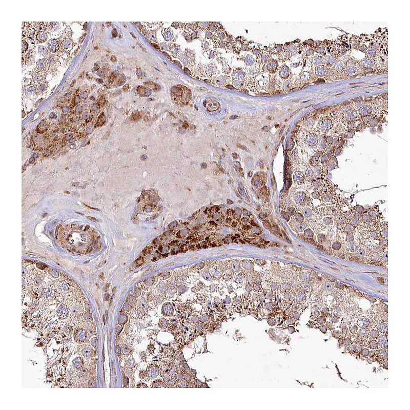 Atlas Antibodies Anti-PSTK Antibody