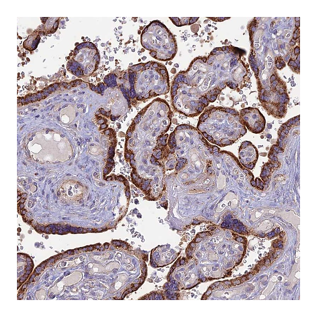Atlas Antibodies Anti-PTCD2 Antibody