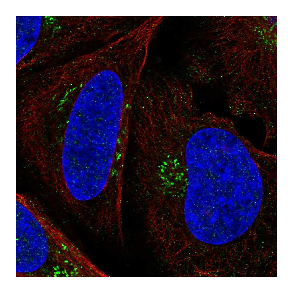 Atlas Antibodies Anti-PTCH1 Antibody