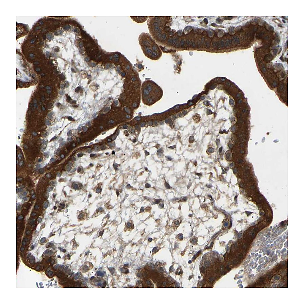 Atlas Antibodies Anti-PTCD1 Antibody