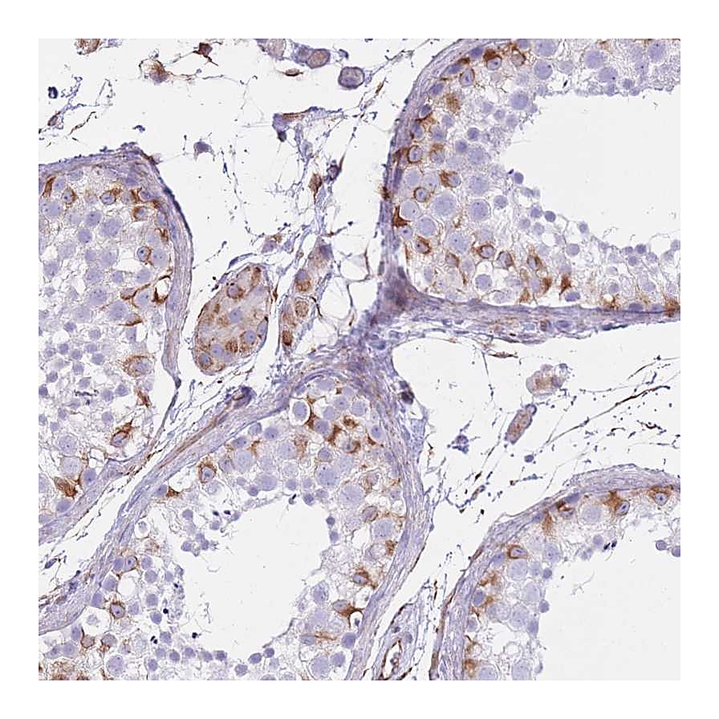 Atlas Antibodies Anti-PTCD1 Antibody