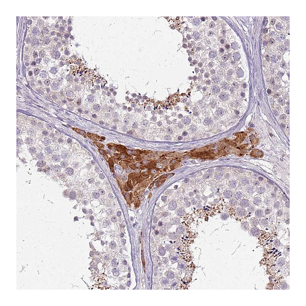 Atlas Antibodies Anti-PTCHD3 Antibody