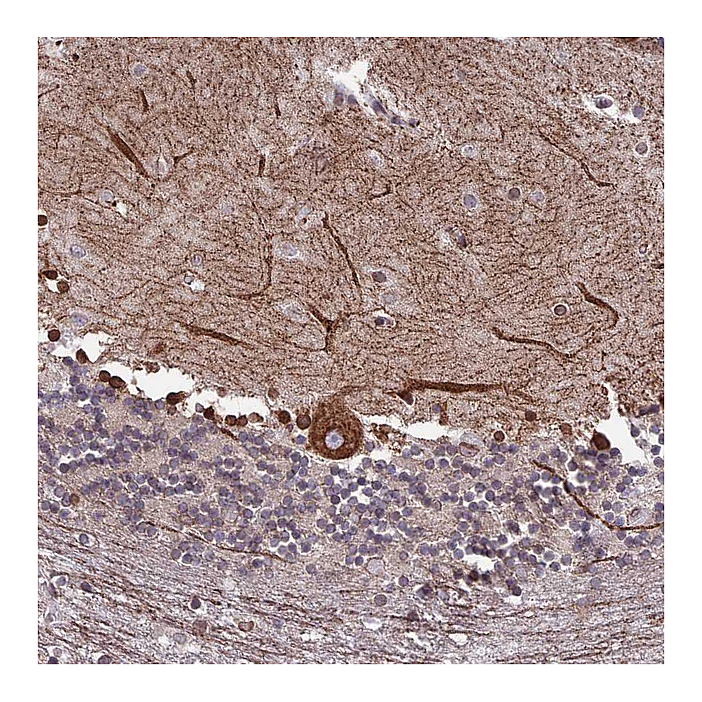 Atlas Antibodies Anti-PTCHD4 Antibody