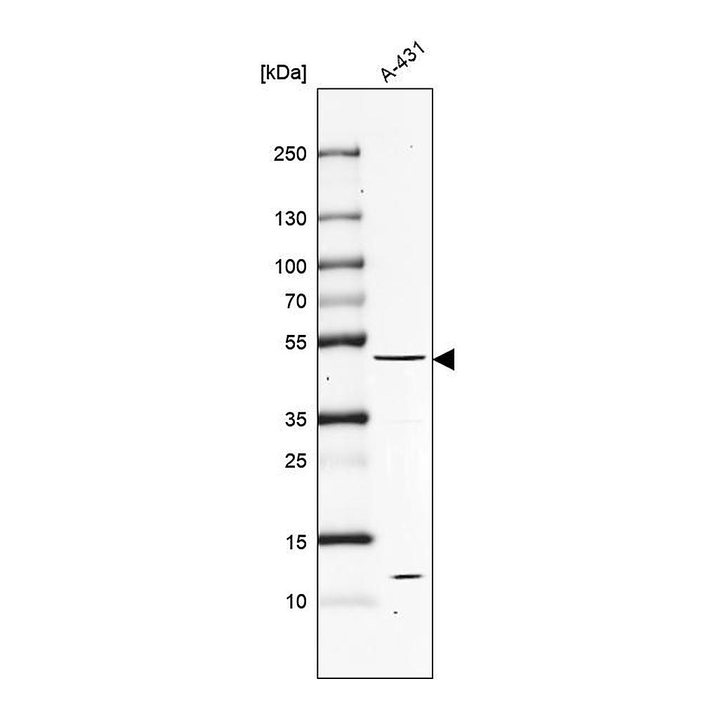 Atlas Antibodies Anti-PTEN Antibody