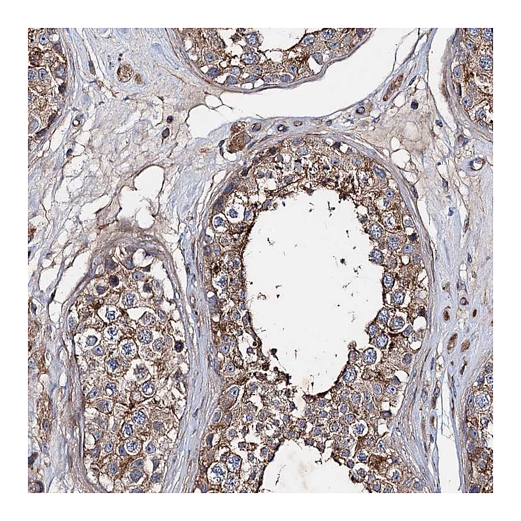 Atlas Antibodies Anti-PTDSS2 Antibody