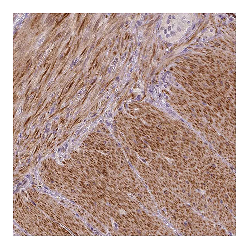 Atlas Antibodies Anti-PTGER3 Antibody