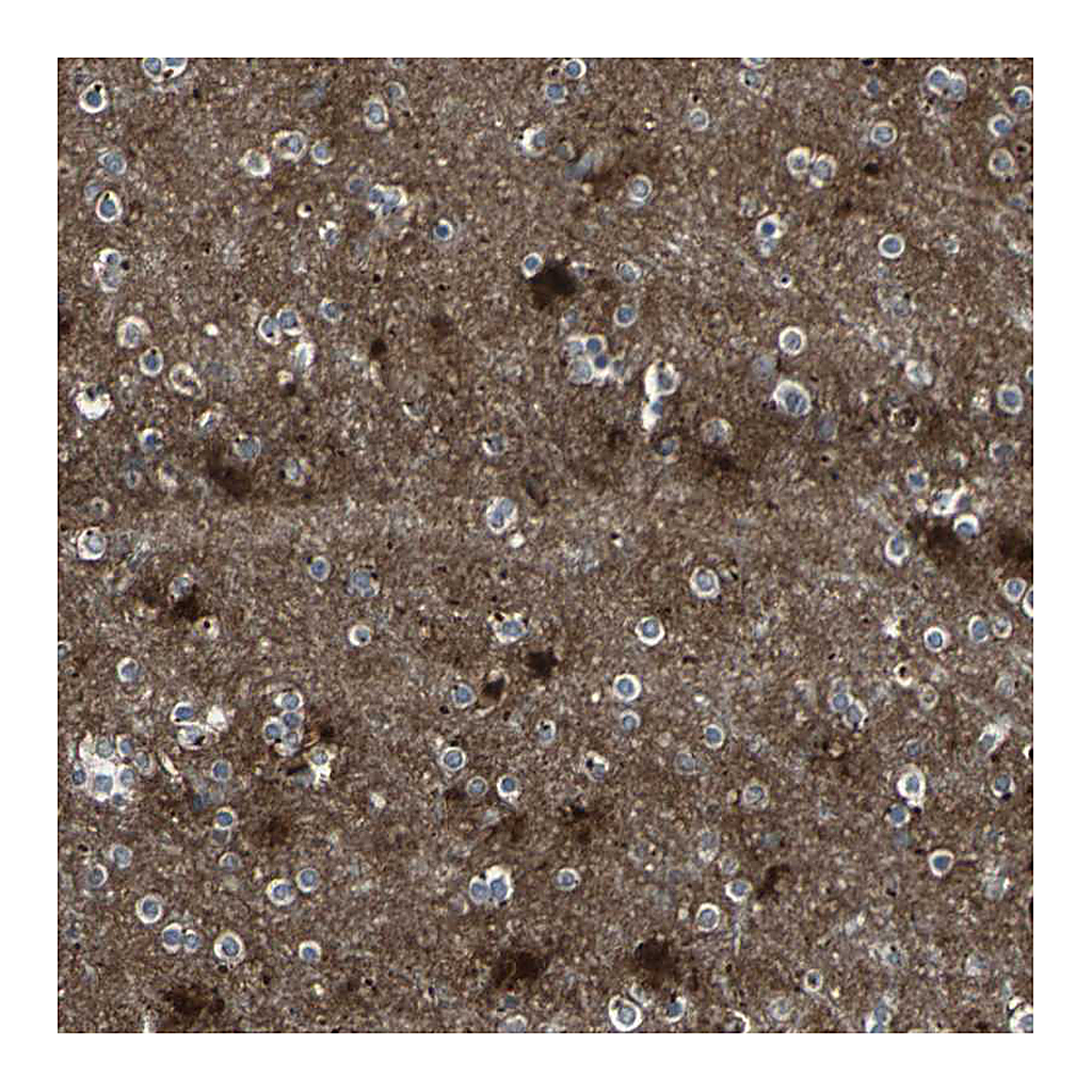 Atlas Antibodies Anti-PTGDS Antibody