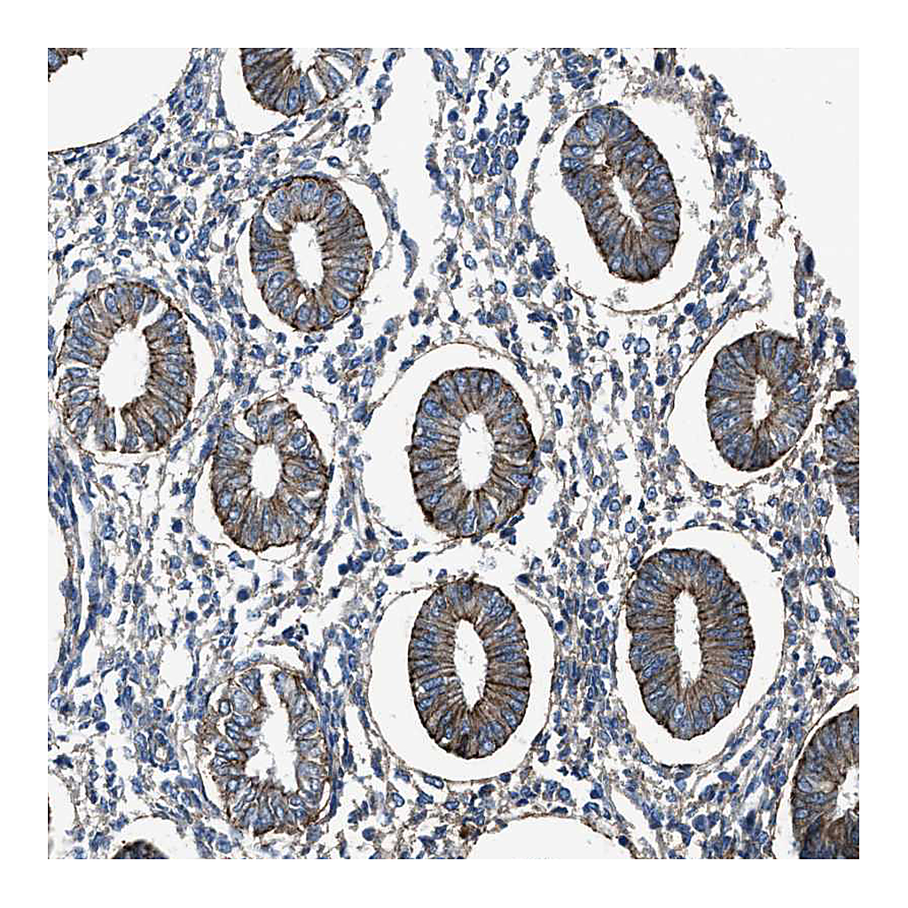 Atlas Antibodies Anti-PTGFRN Antibody