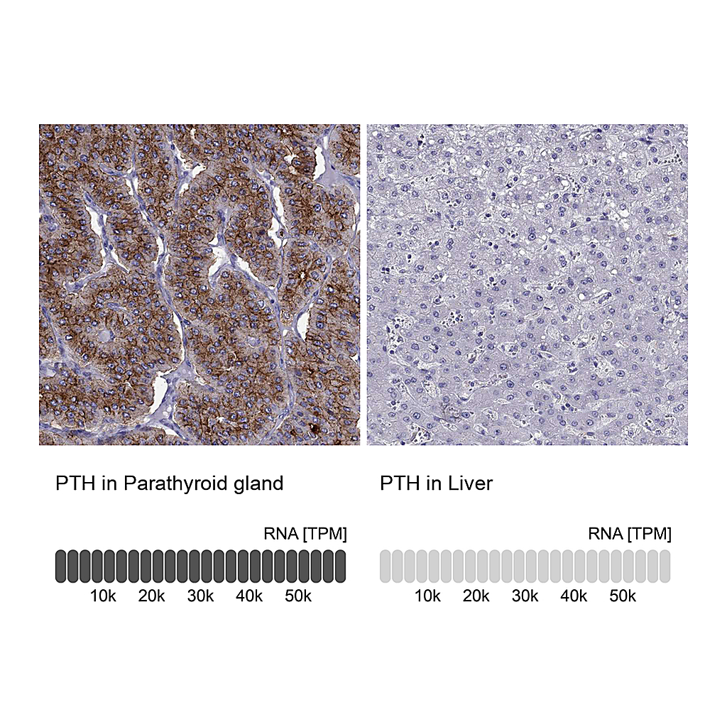 Atlas Antibodies Anti-PTH Antibody