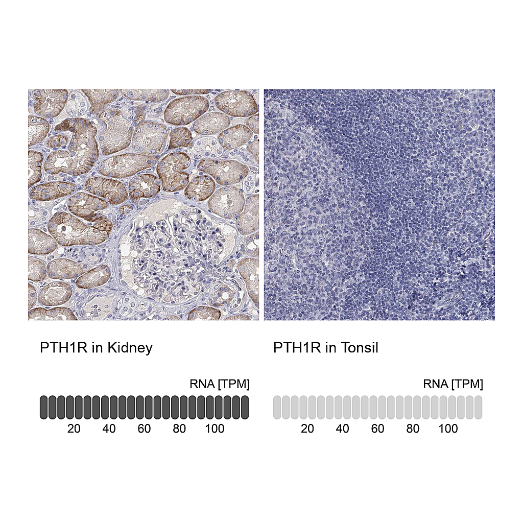 Atlas Antibodies Anti-PTH1R Antibody