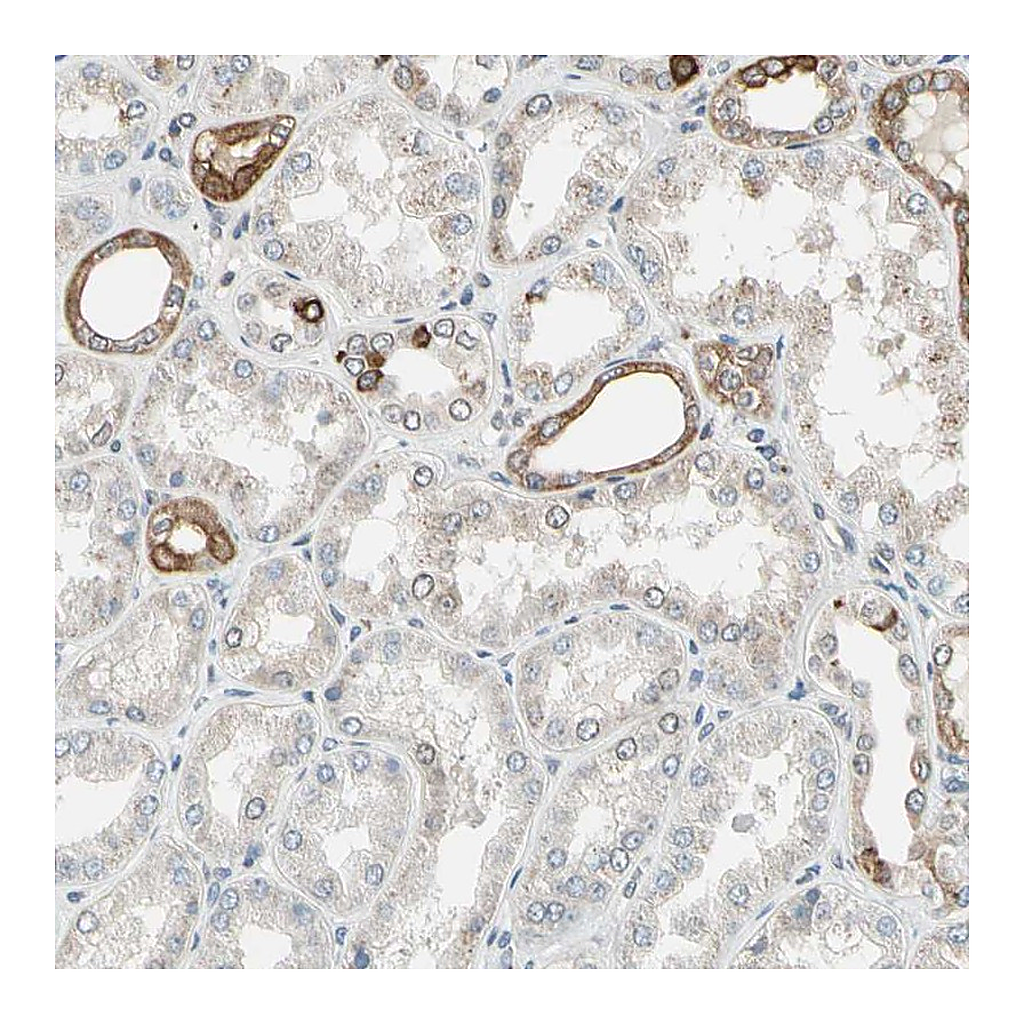 Atlas Antibodies Anti-PTH1R Antibody
