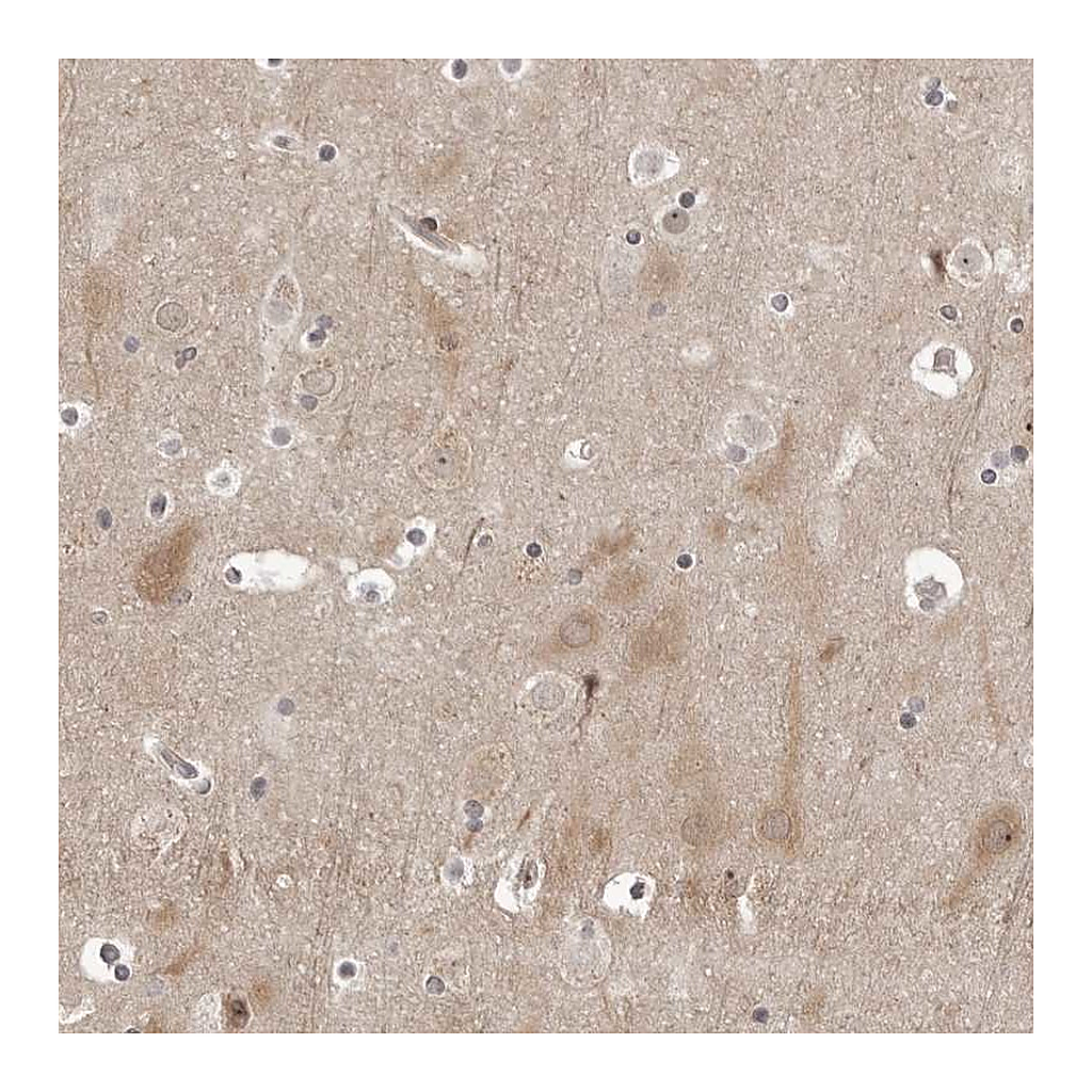 Atlas Antibodies Anti-PTK2B Antibody