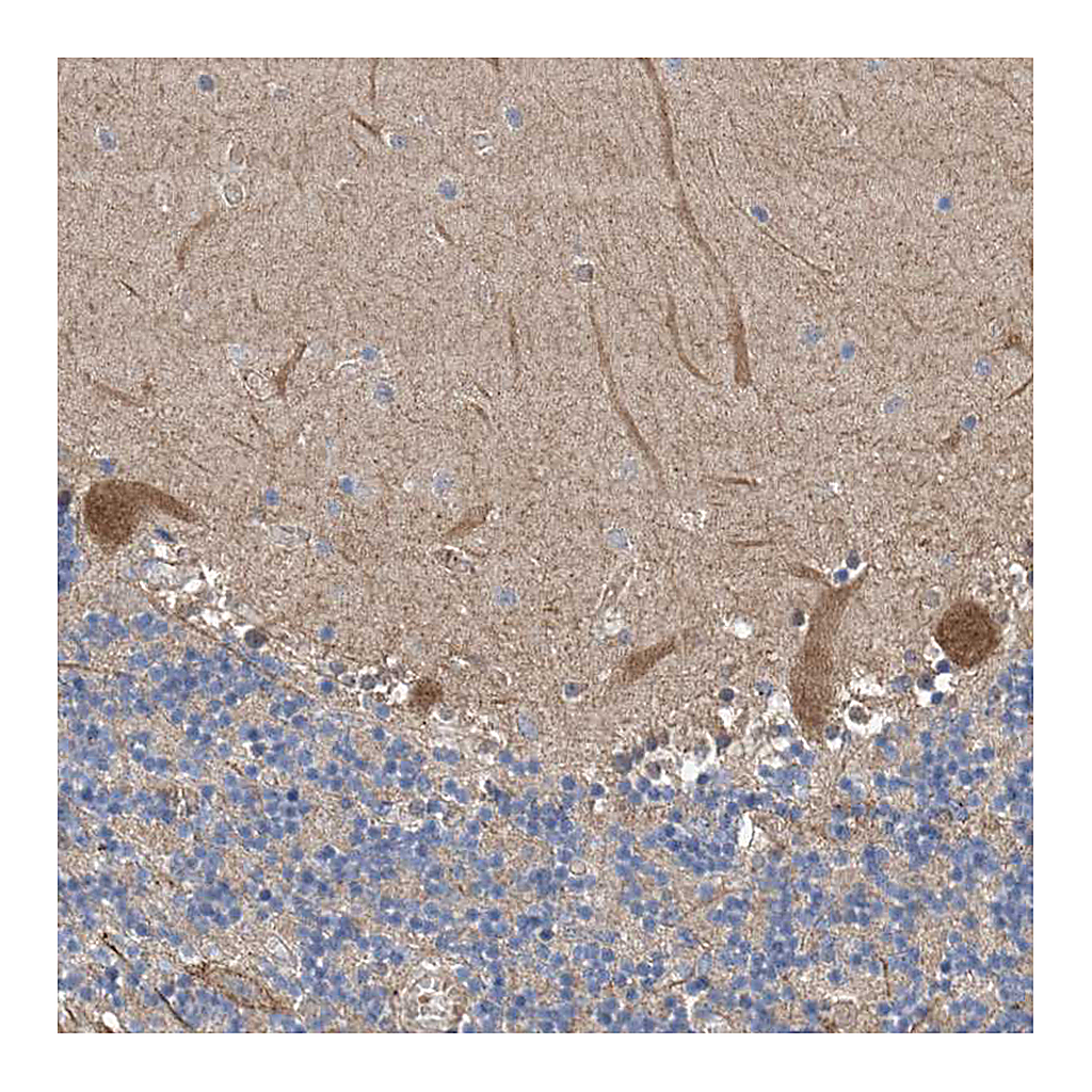 Atlas Antibodies Anti-PTK2 Antibody