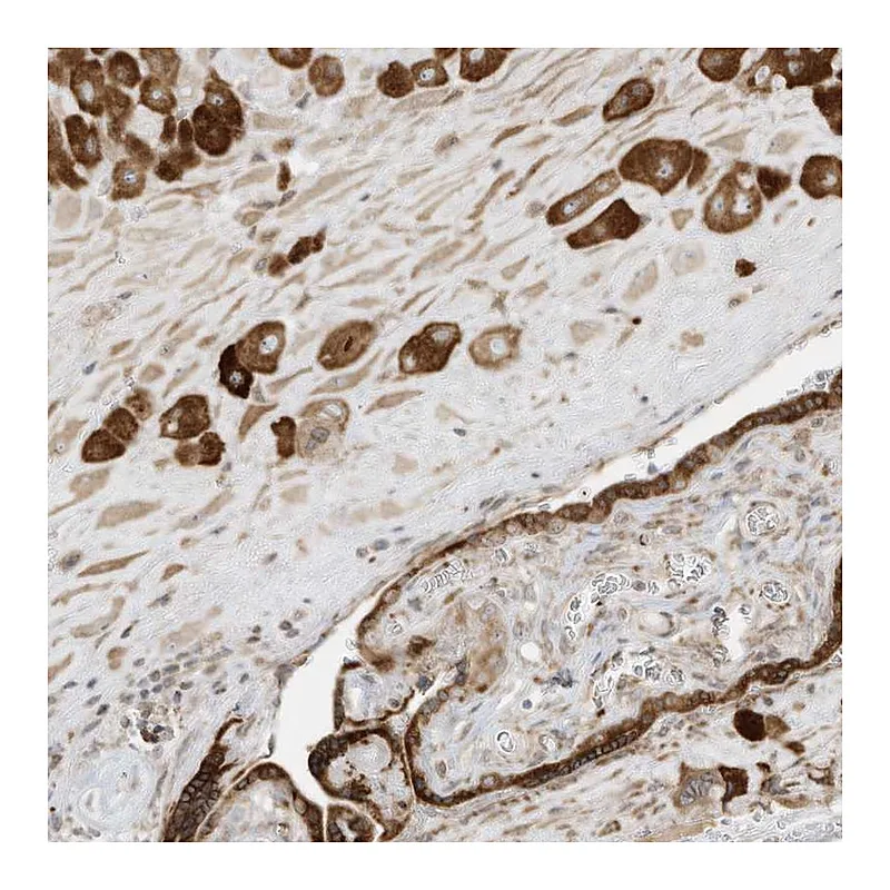 Atlas Antibodies Anti-PTK6 Antibody