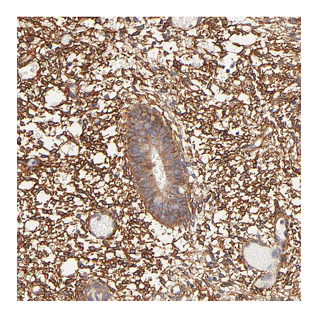 Atlas Antibodies Anti-PTK7 Antibody