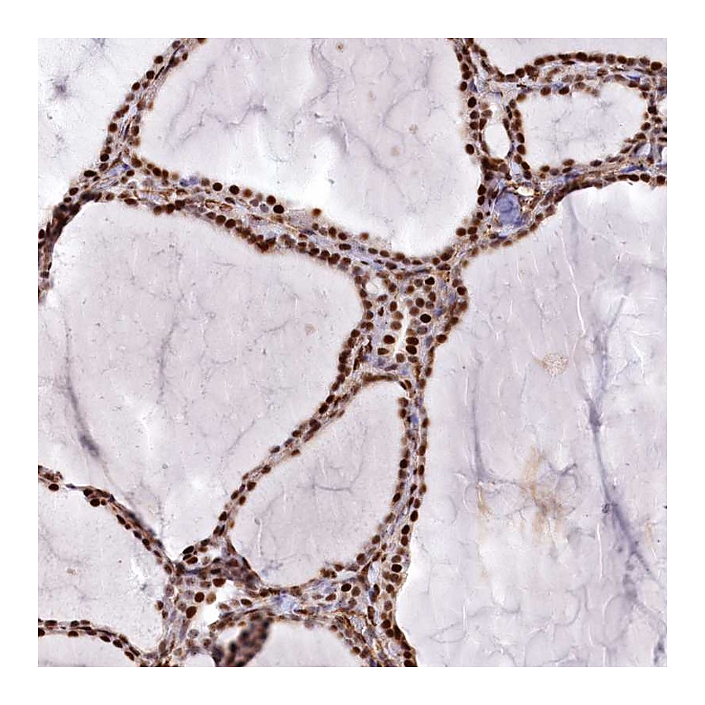 Atlas Antibodies Anti-PTMS Antibody