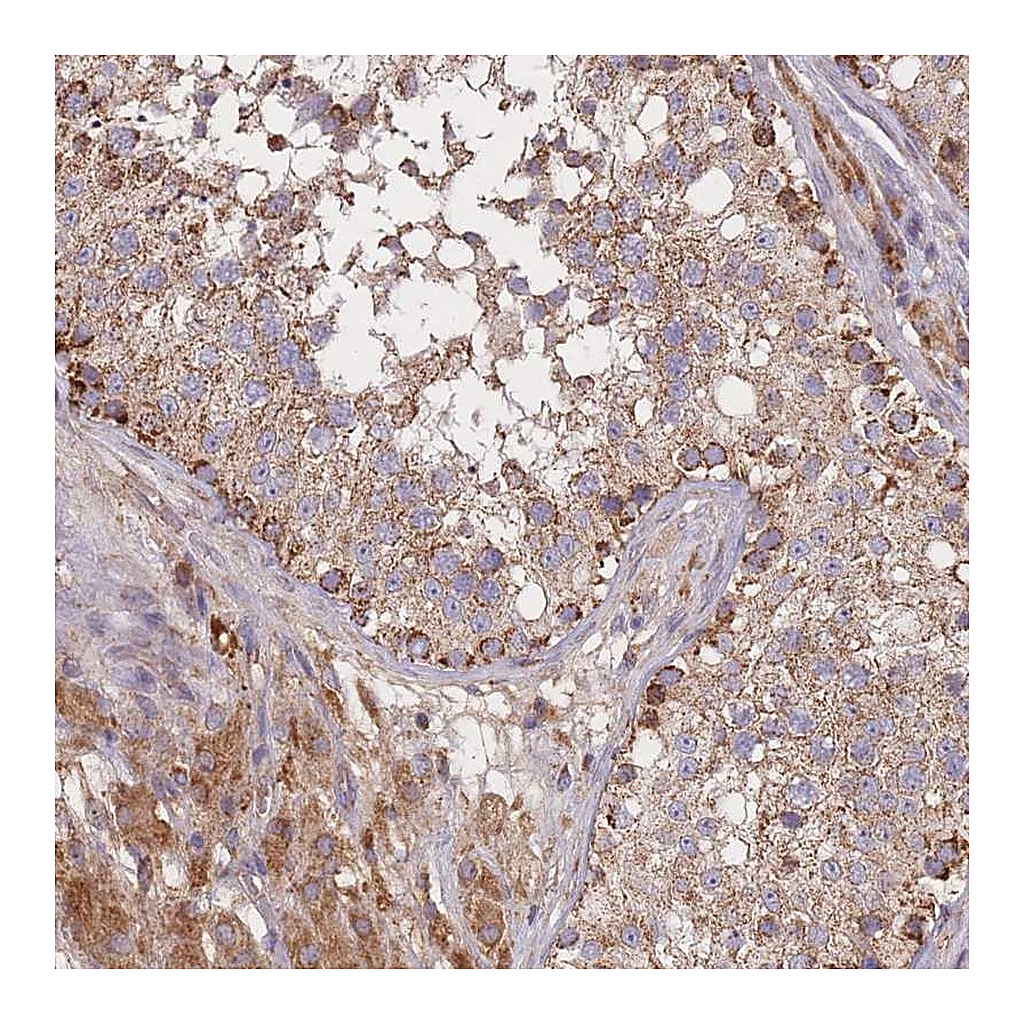 Atlas Antibodies Anti-PTPMT1 Antibody