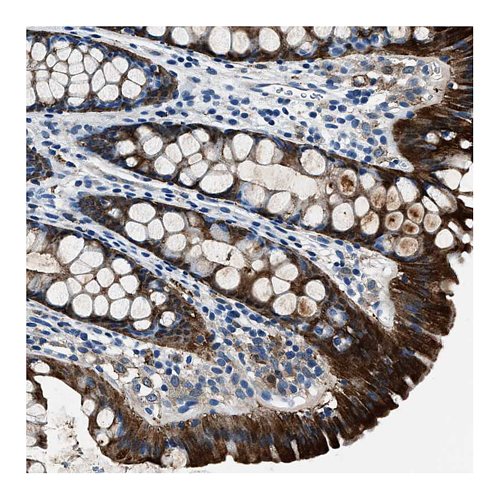 Atlas Antibodies Anti-PTPDC1 Antibody