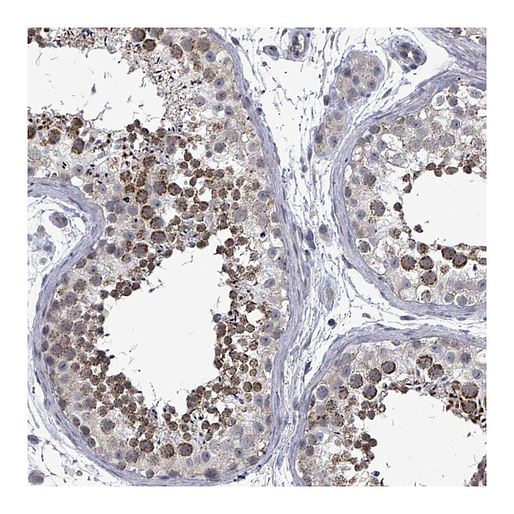 Atlas Antibodies Anti-PTPN20 Antibody