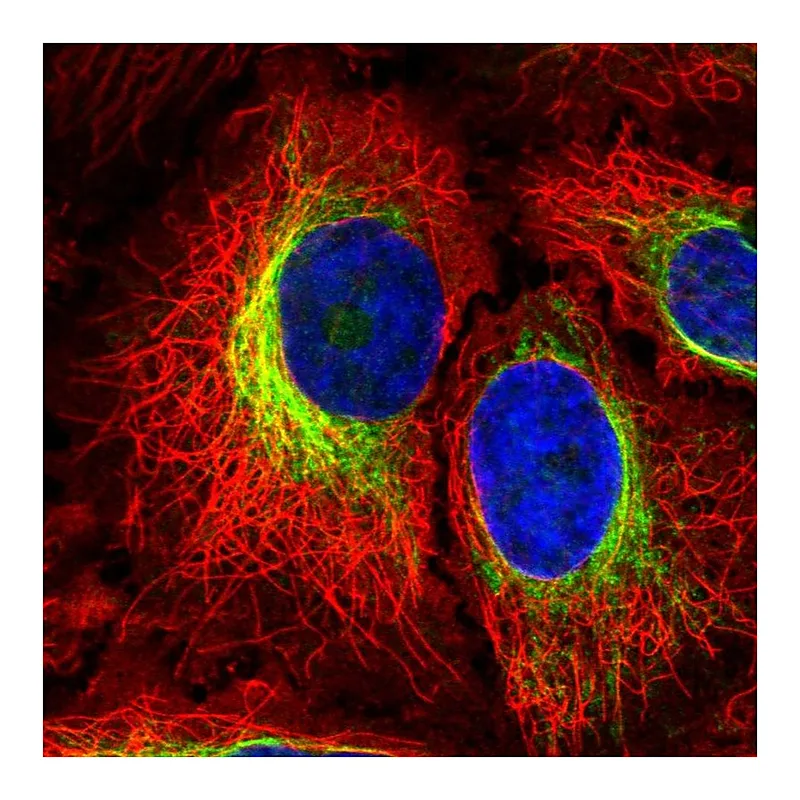 Atlas Antibodies Anti-PTPN18 Antibody