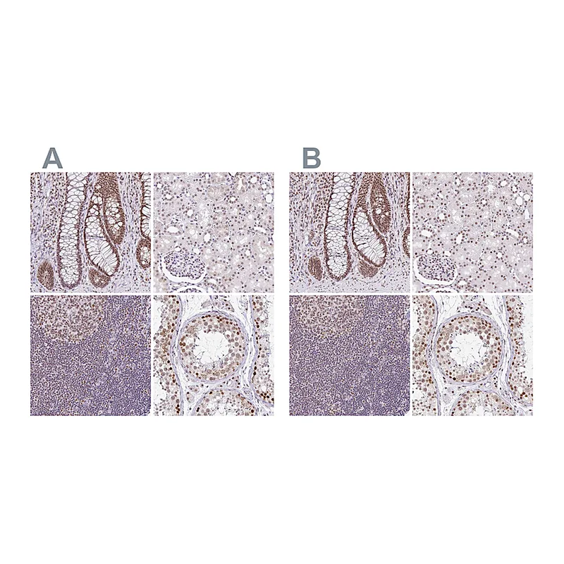 Atlas Antibodies Anti-PTPN2 Antibody