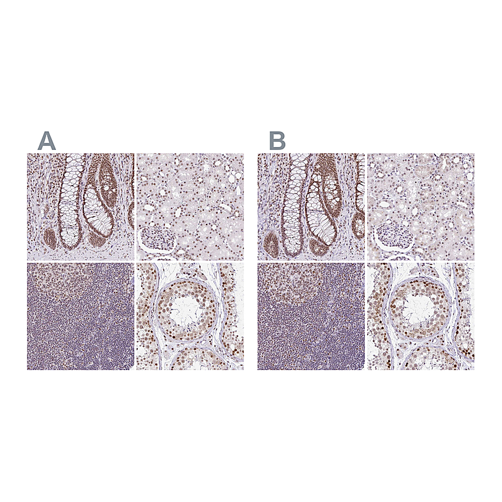 Atlas Antibodies Anti-PTPN2 Antibody