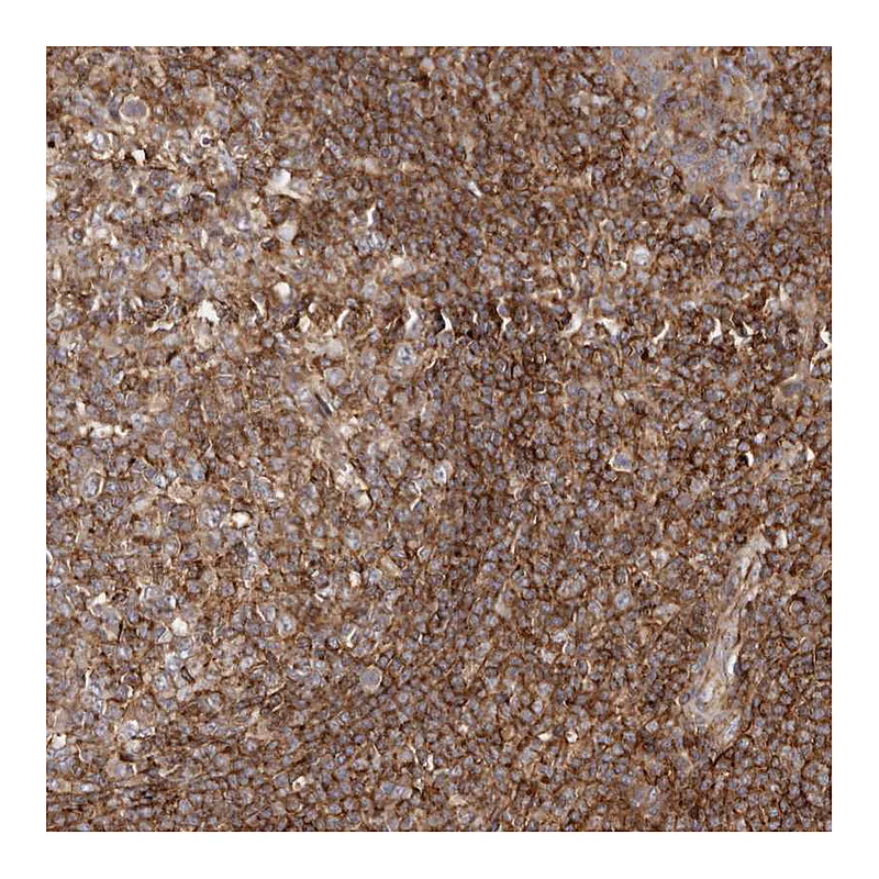 Atlas Antibodies Anti-PTPN22 Antibody