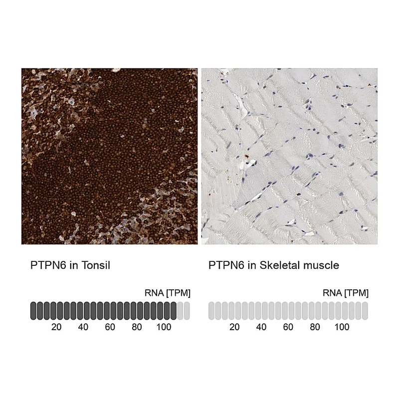 Atlas Antibodies Anti-PTPN6 Antibody