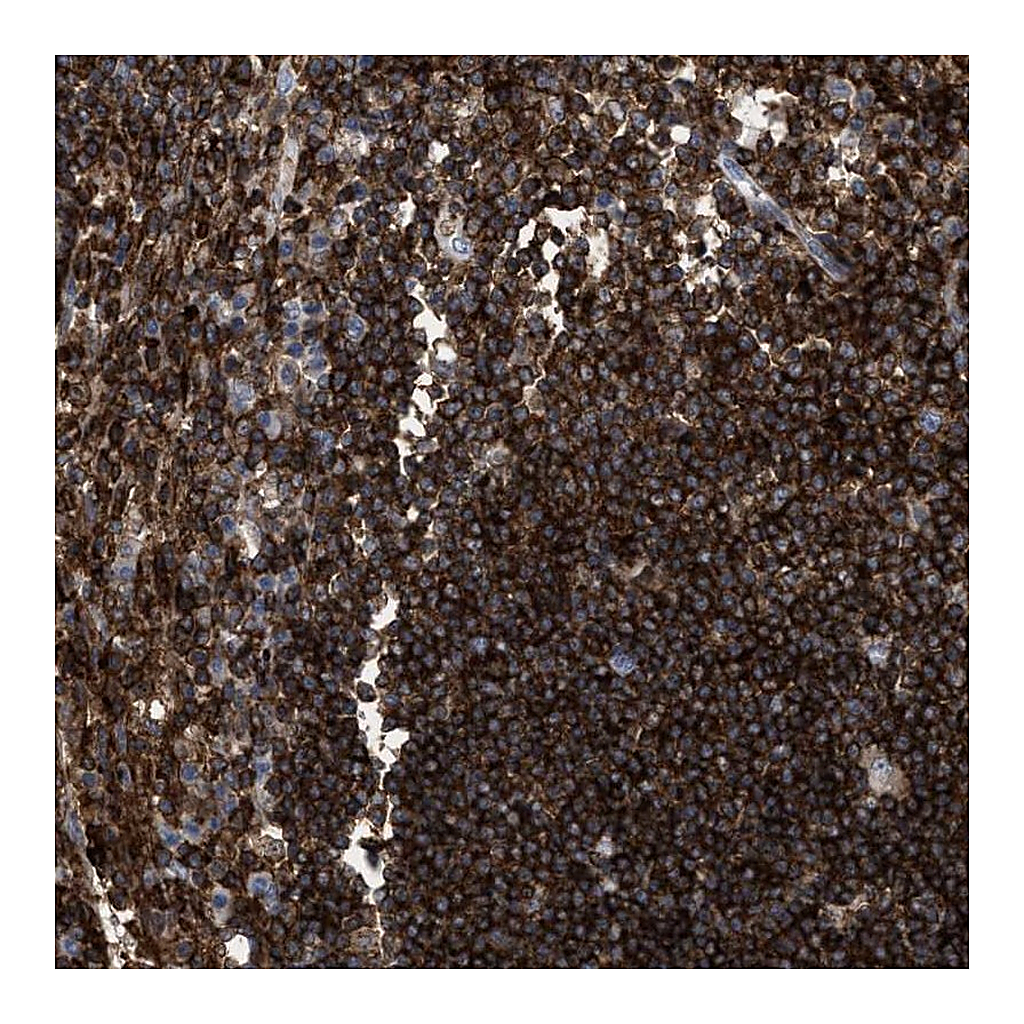 Atlas Antibodies Anti-PTPRE Antibody