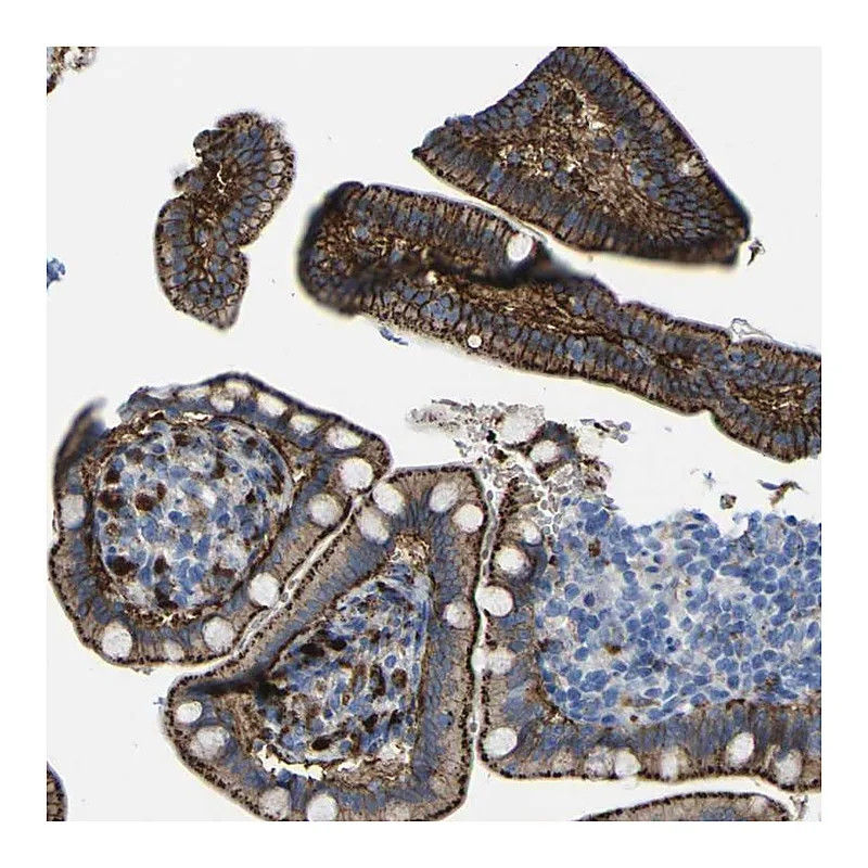Atlas Antibodies Anti-PTPRF Antibody