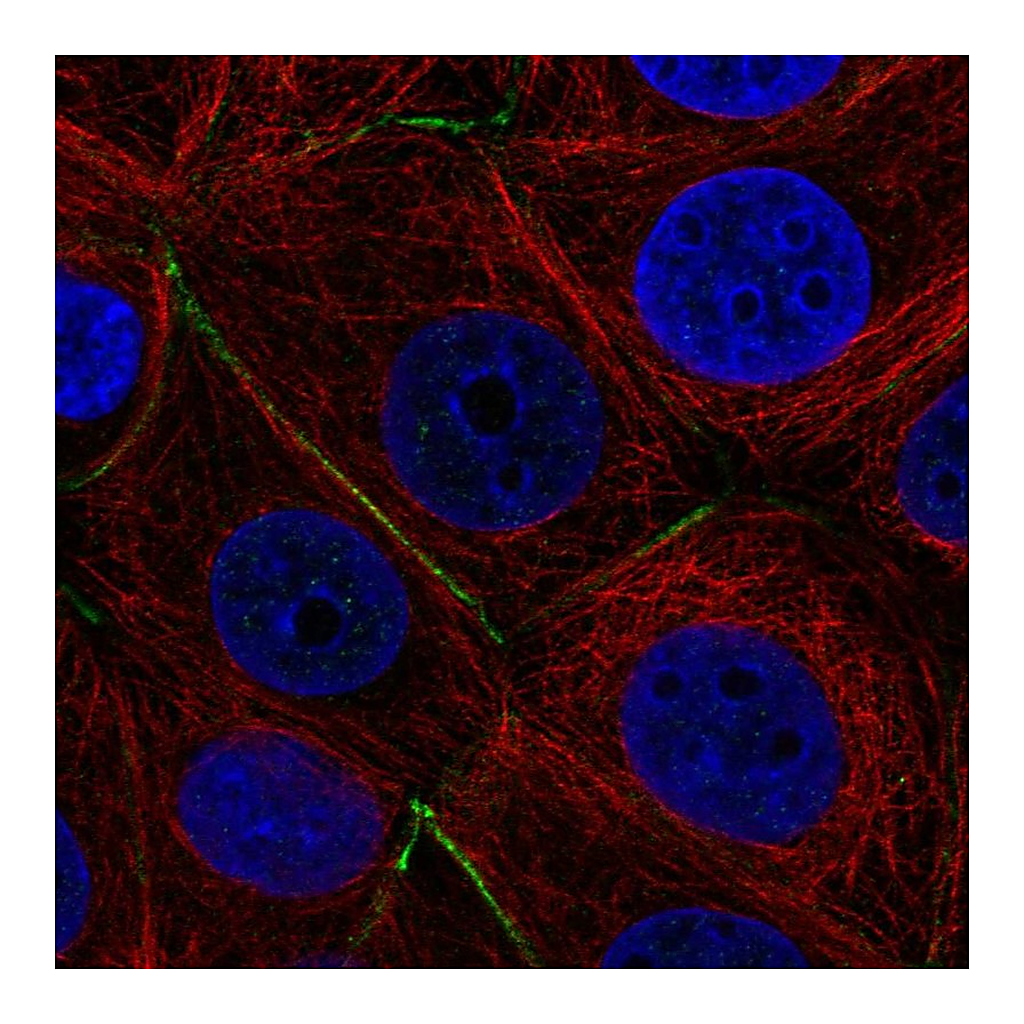 Atlas Antibodies Anti-PTPRK Antibody