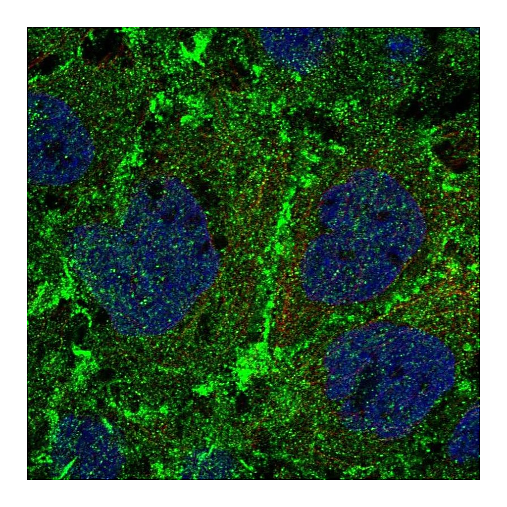 Atlas Antibodies Anti-PTPRM Antibody