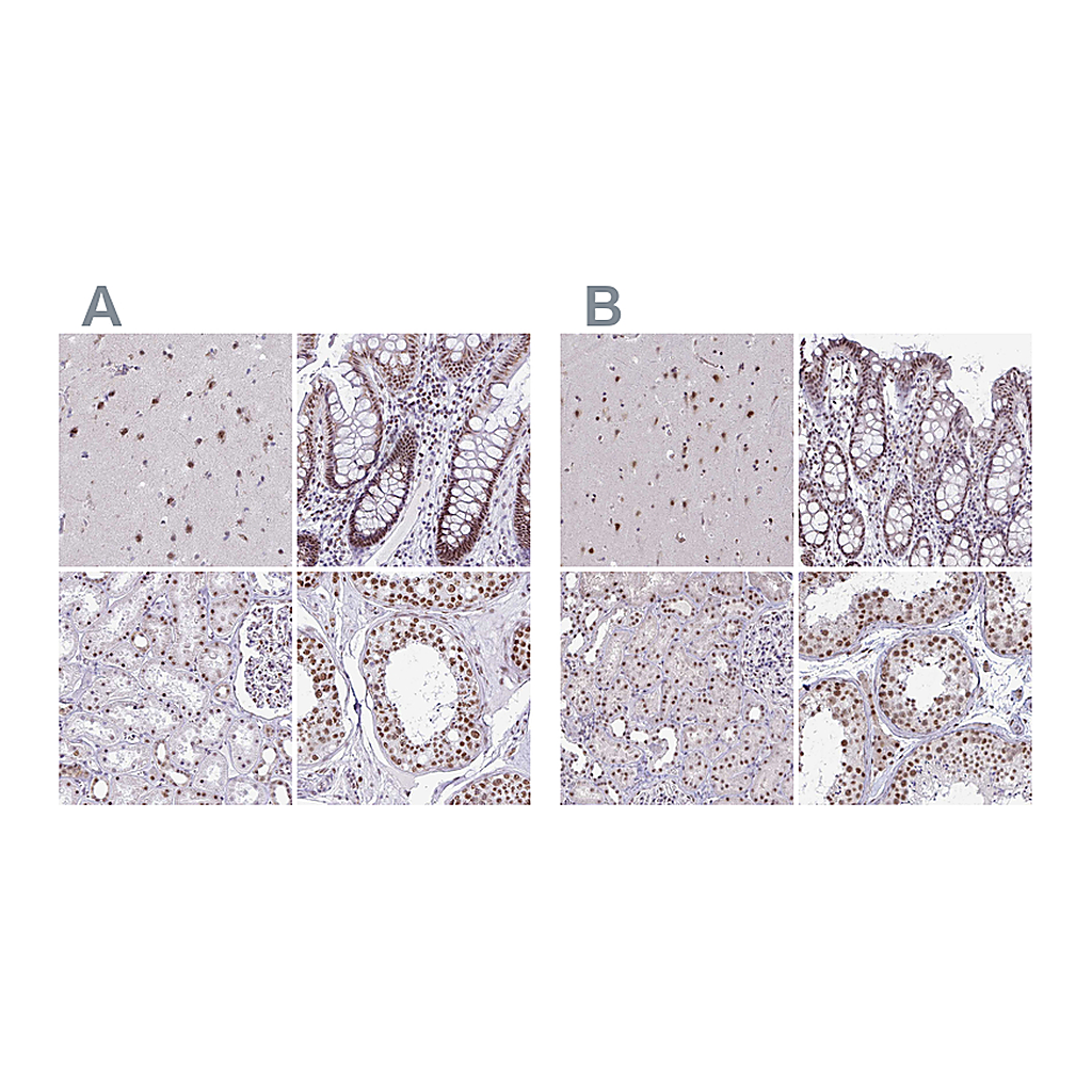 Atlas Antibodies Anti-PUF60 Antibody
