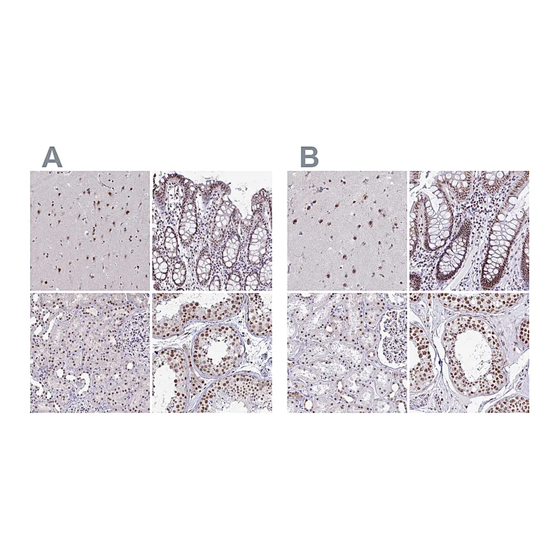 Atlas Antibodies Anti-PUF60 Antibody