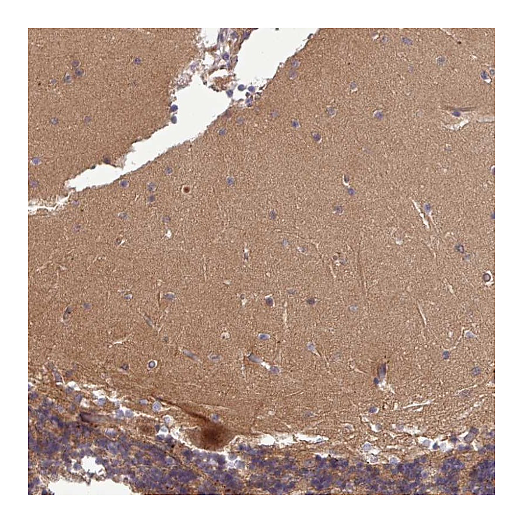 Atlas Antibodies Anti-PUS1 Antibody