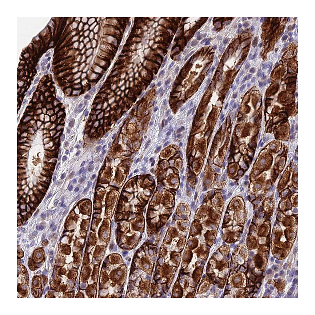 Atlas Antibodies Anti-PUS10 Antibody