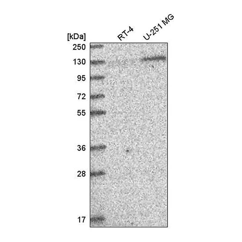 Atlas Antibodies Anti-PUM2 Antibody