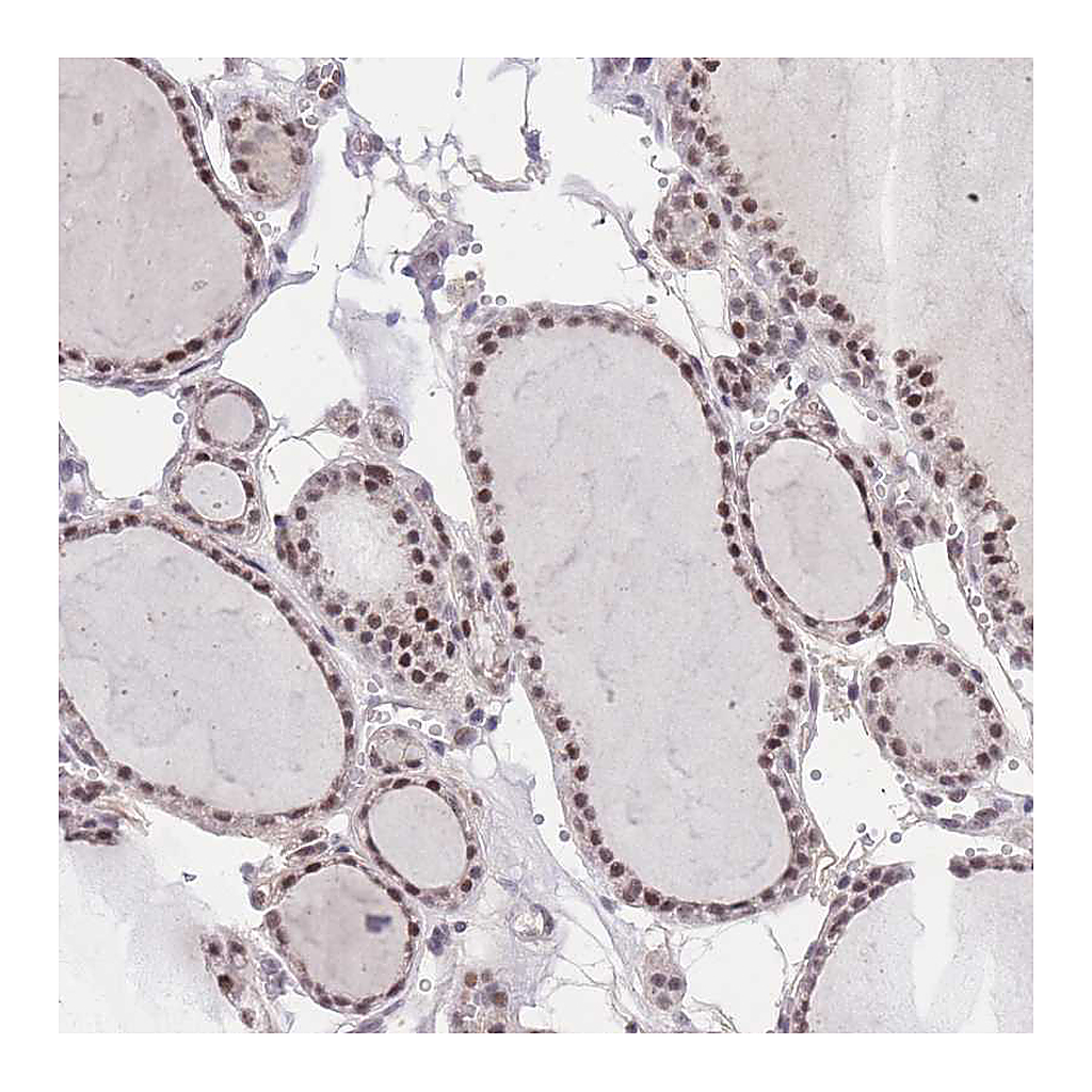 Atlas Antibodies Anti-PUS10 Antibody