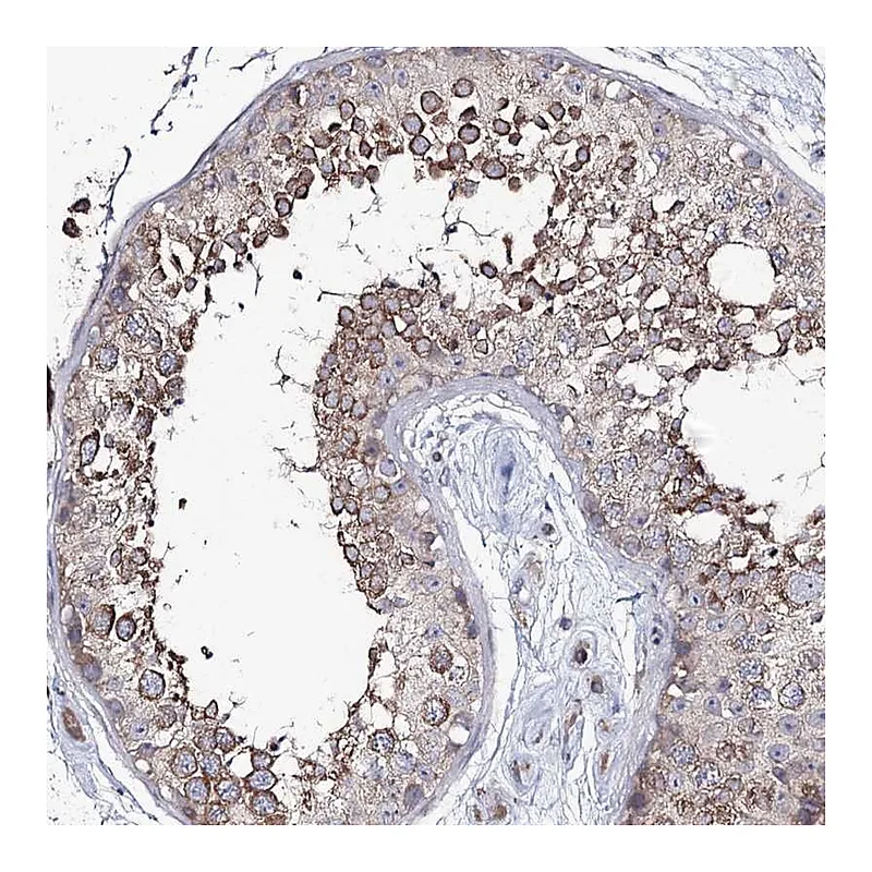 Atlas Antibodies Anti-PUS3 Antibody