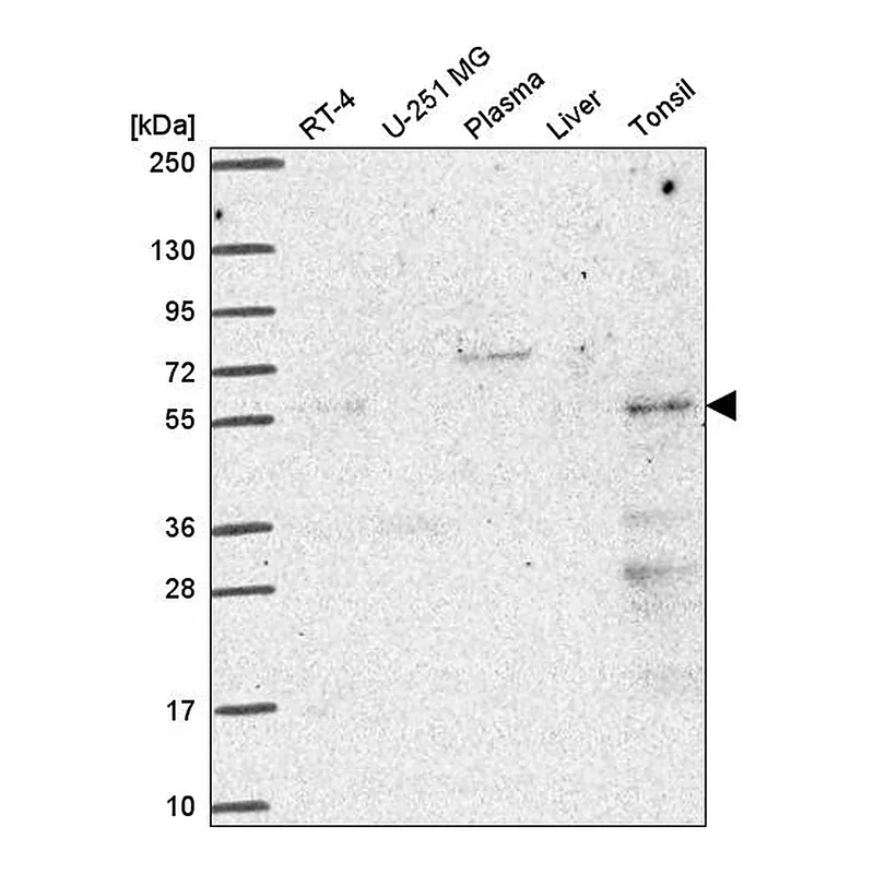 Atlas Antibodies Anti-PUS3 Antibody