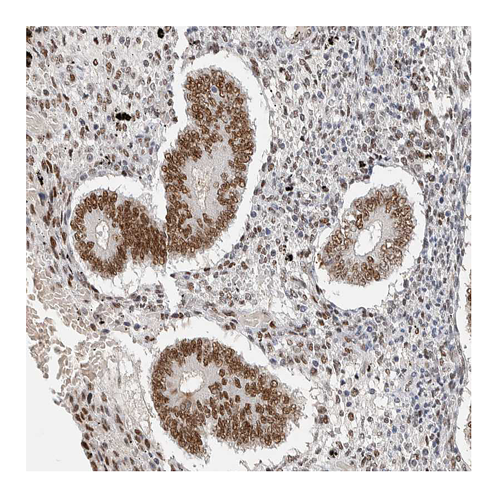Atlas Antibodies Anti-PUS7 Antibody