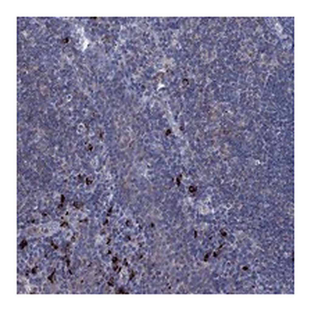 Atlas Antibodies Anti-PVR Antibody