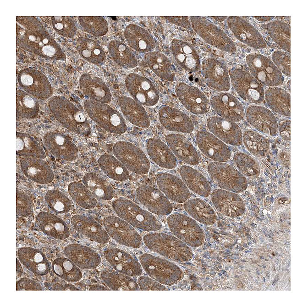 Atlas Antibodies Anti-PUSL1 Antibody