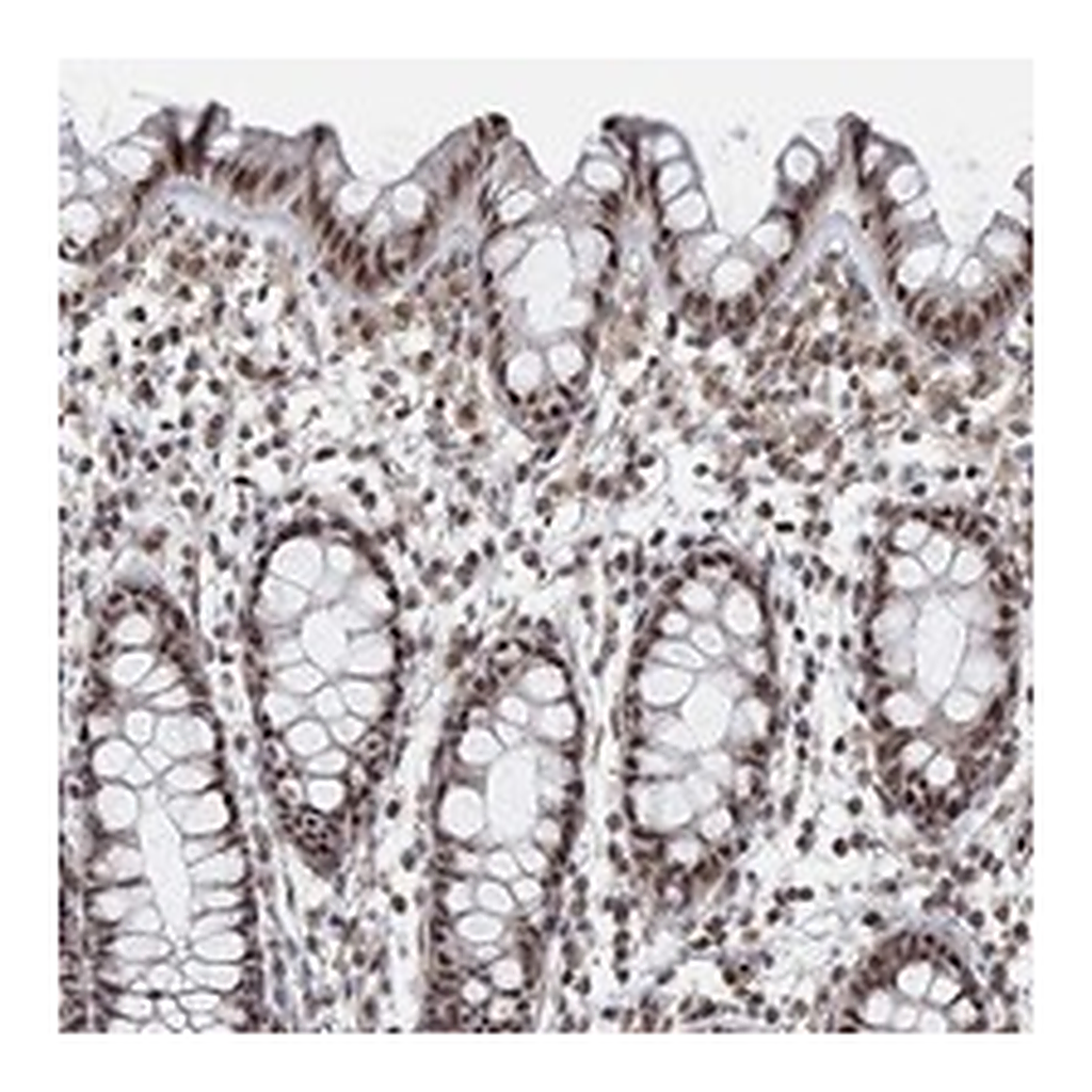 Atlas Antibodies Anti-PWWP2B Antibody