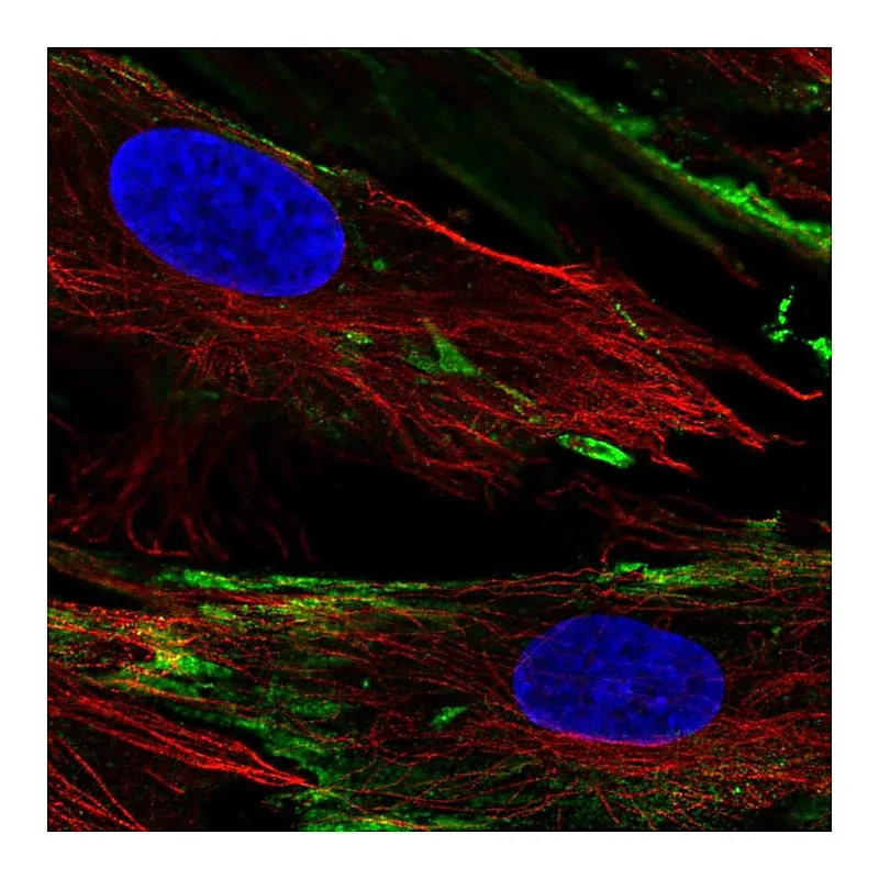 Atlas Antibodies Anti-PXDC1 Antibody