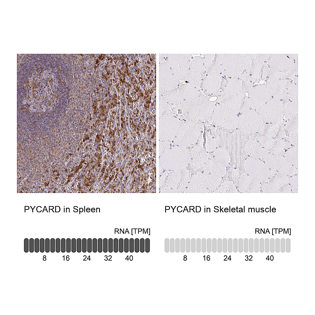 Atlas Antibodies Anti-PYCARD Antibody